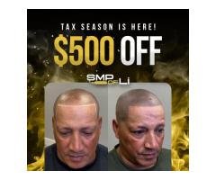 How Long Does Scalp Micropigmentation Last